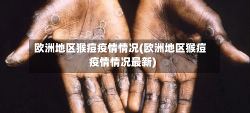 欧洲地区猴痘疫情情况(欧洲地区猴痘疫情情况最新)