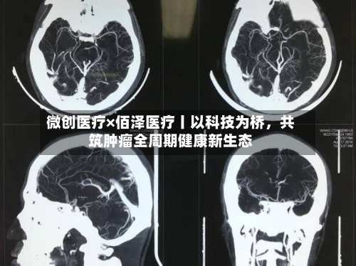 微创医疗×佰泽医疗丨以科技为桥	，共筑肿瘤全周期健康新生态-第2张图片