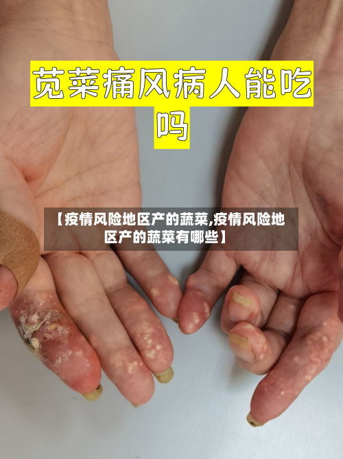 【疫情风险地区产的蔬菜,疫情风险地区产的蔬菜有哪些】-第2张图片