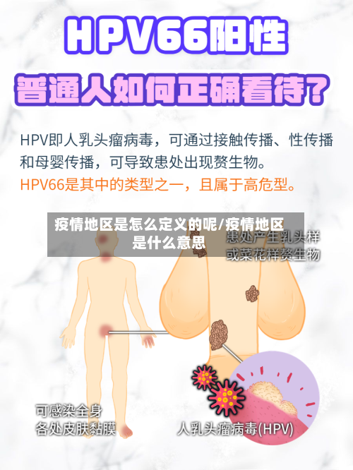 疫情地区是怎么定义的呢/疫情地区是什么意思