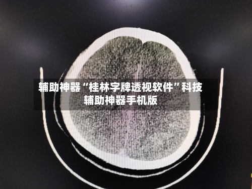 辅助神器“桂林字牌透视软件	”科技辅助神器手机版-第2张图片
