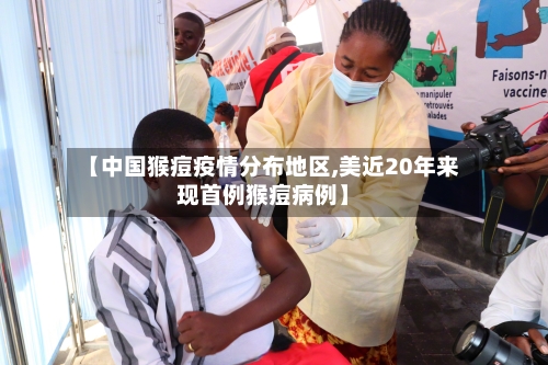 【中国猴痘疫情分布地区,美近20年来现首例猴痘病例】
