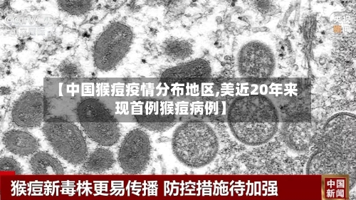 【中国猴痘疫情分布地区,美近20年来现首例猴痘病例】-第3张图片