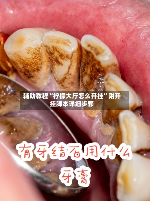 辅助教程“柠檬大厅怎么开挂”附开挂脚本详细步骤-第2张图片