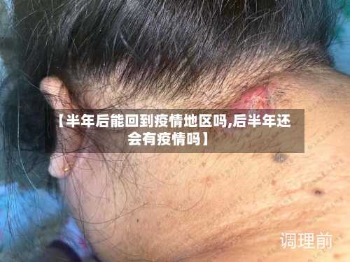 【半年后能回到疫情地区吗,后半年还会有疫情吗】